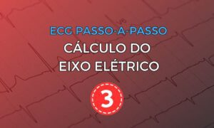 Eletrocardiograma com artefato