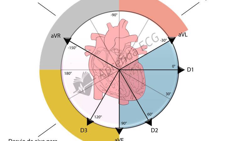 Eletrocardiograma com hipercalemia