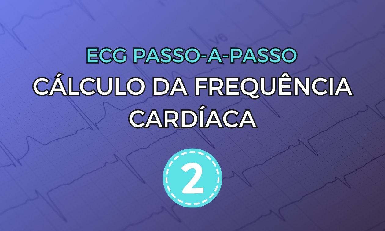 Eletrocardiograma com cardiomiopatia hipertrófica