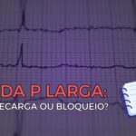 Eletrocardiograma com troca de eletrodos