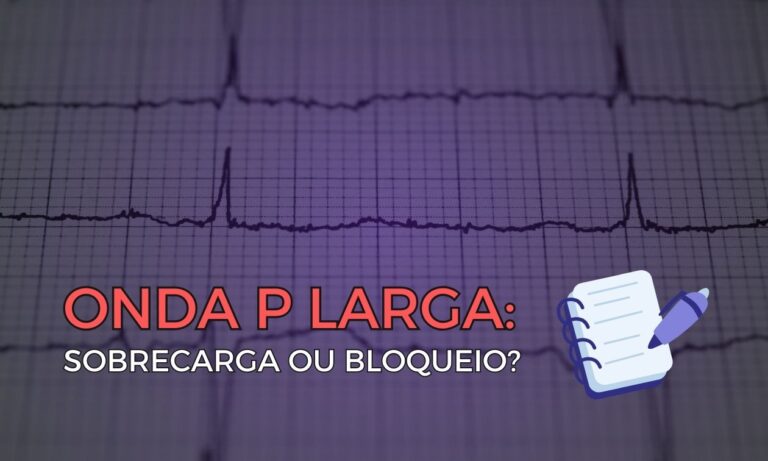 Algoritmo CHADSVA para fibrilação atrial