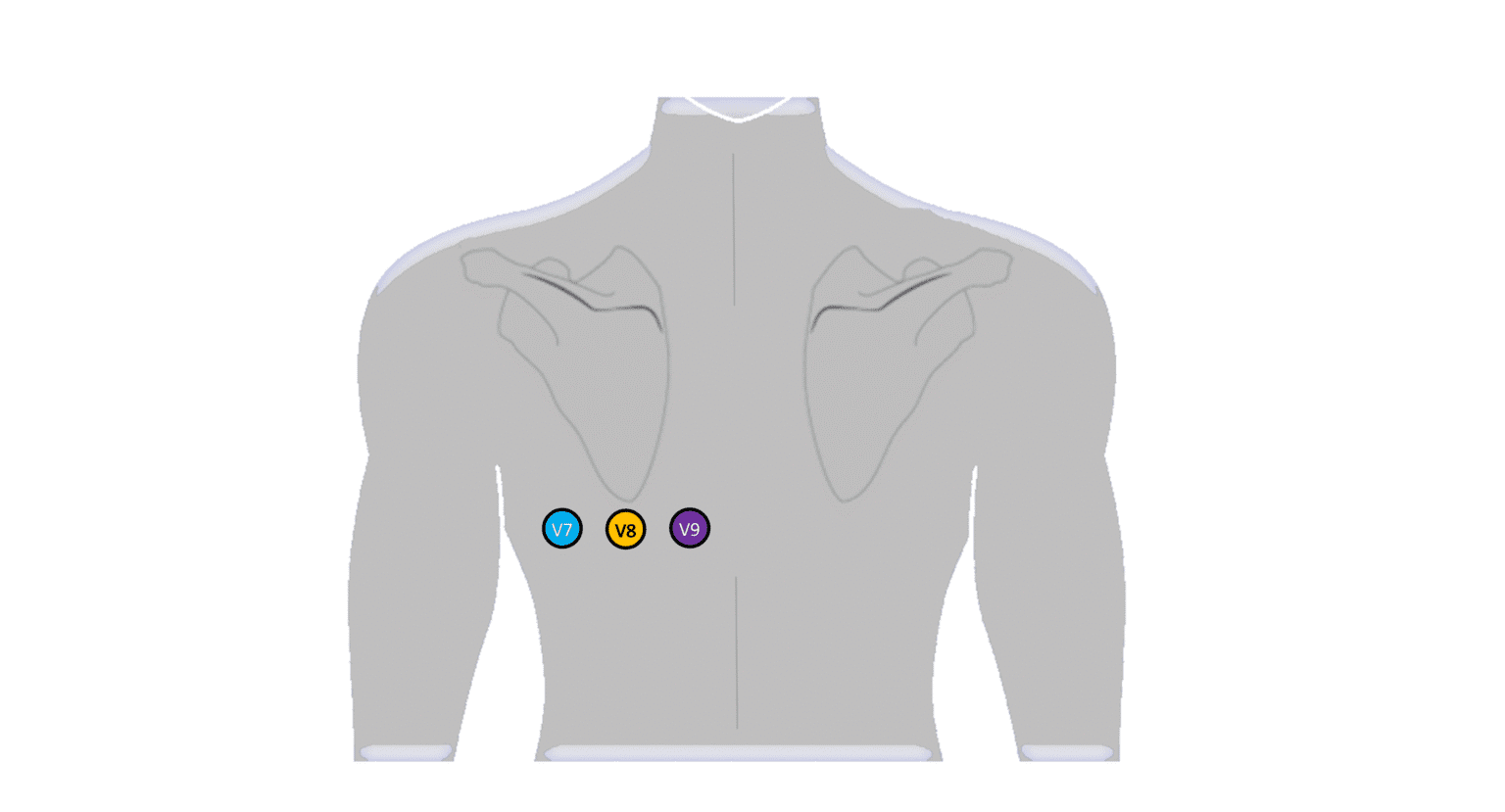 Livro ECG Passo a Passo