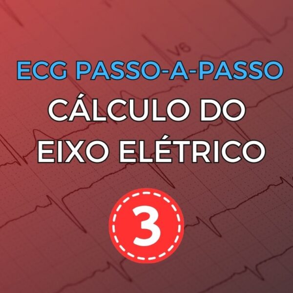 Eletrocardiograma com pericardite aguda