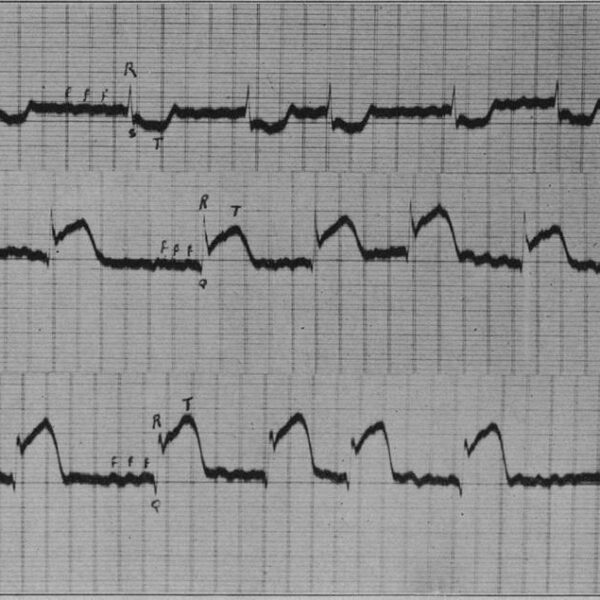 Livros Tratado de ECG