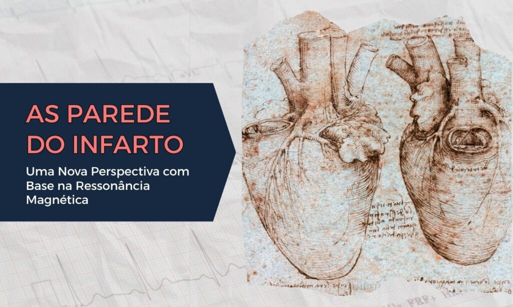 Ativação elétrica atrial