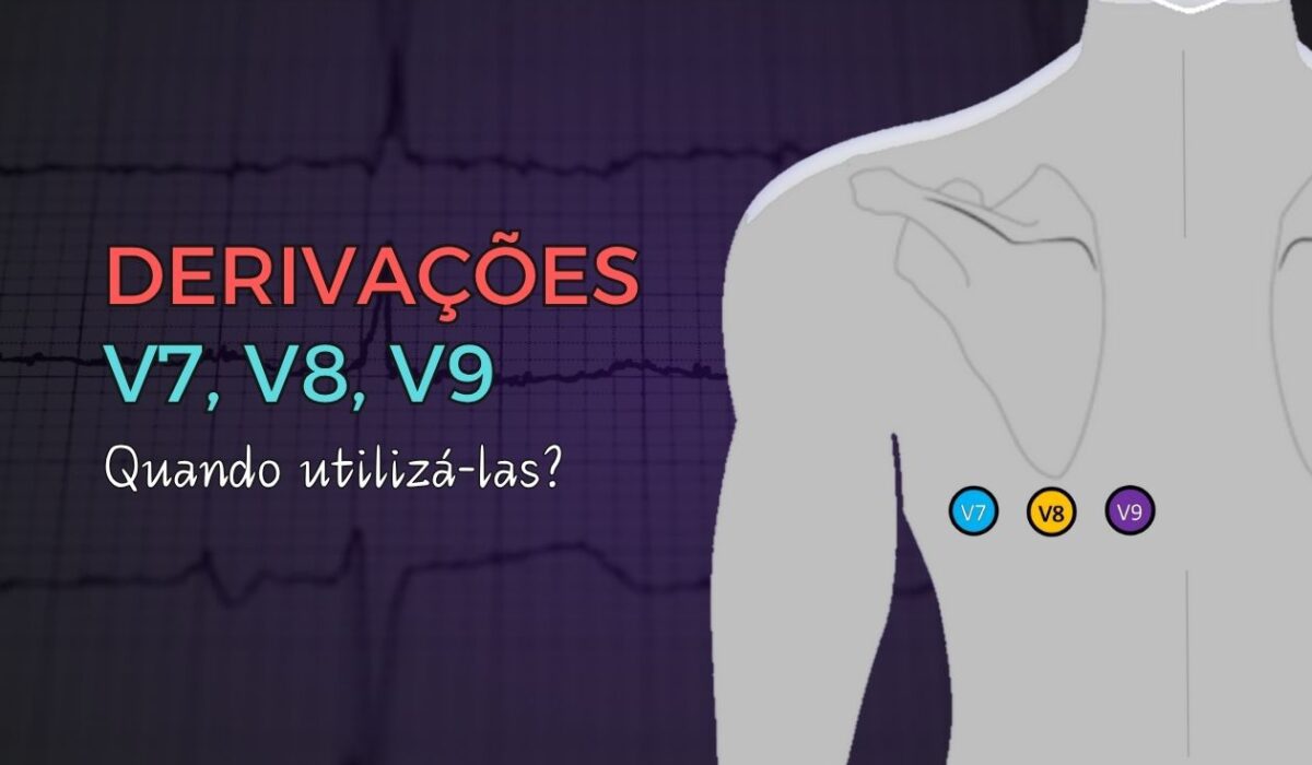 ondas e intervalos ECG