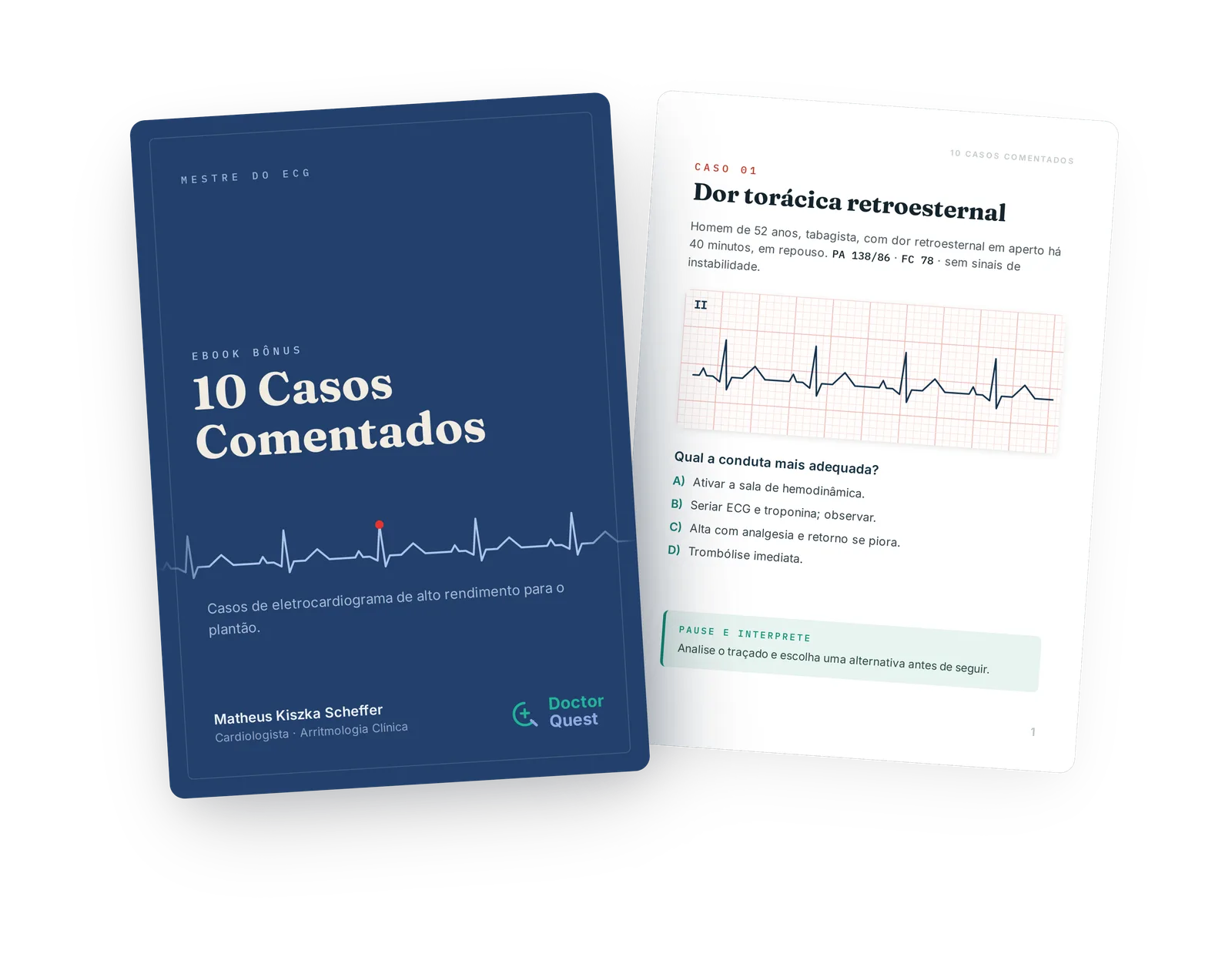 Mockup do Ebook 10 Casos Comentados — capa e página interna do Caso 01, dor torácica retroesternal, com traçado e alternativas