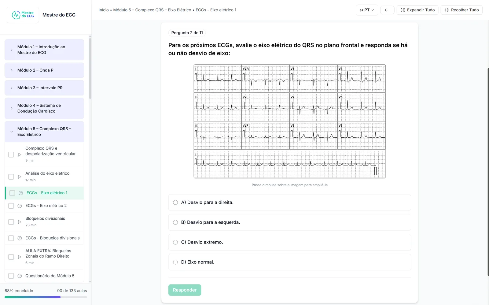 Simulado do curso: questão de múltipla escolha com ECG de 12 derivações e alternativas sobre o eixo elétrico do QRS
